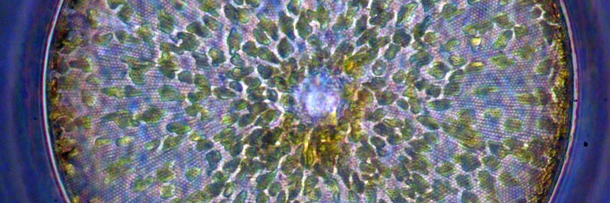 Detail from a phase contrast micrograph of Coscinodiscus wailesii from the Wyre estuary 16th January 2025, by Barry Kaye