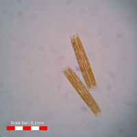 Pennate diatoms Pennate diatoms