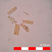 Chains of diatoms from the Sound of Mull, 2007-04-11. Chains of diatoms from the Sound of Mull, 2007-04-11.